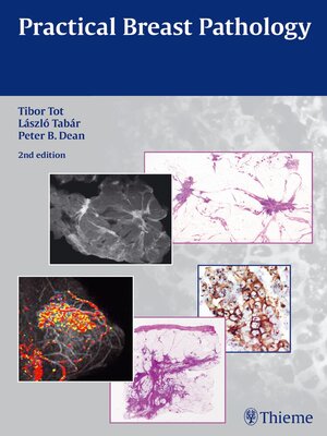 cover image of Practical Breast Pathology